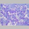Pancreas SF 06.jpg